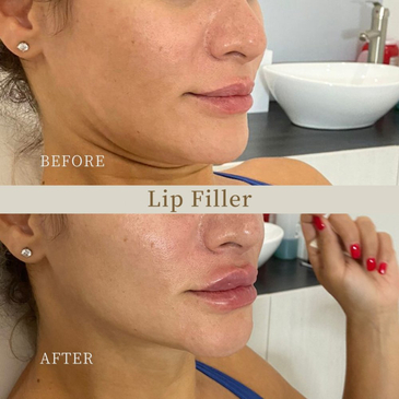 Slider image (2) 4 Ever Youthful Medical Studio Aesthetic & Regenerative Center